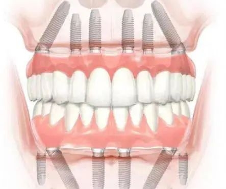 三、株洲家鴻口腔醫(yī)院服務(wù)暖：沒有套路不推銷，本地人看牙更省心