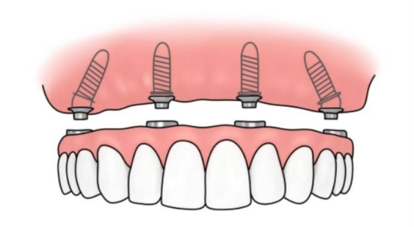 四、株洲家鴻口腔醫(yī)院價格實：收費透明公道，本地人消費得起