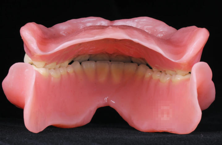 西安諾貝爾口腔全口吸附性假牙價(jià)格14568起：當(dāng)天取模當(dāng)天戴，3D速鑲+免費(fèi)調(diào)適超省心