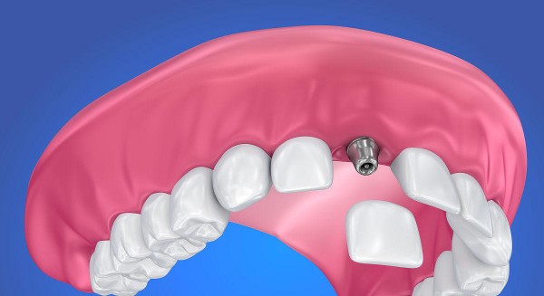 三、維樂口腔醫(yī)院馬連道分院就診攻略：從預(yù)約到術(shù)后，馬連道分院這樣安排