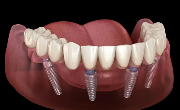 五、總結(jié)