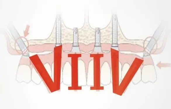 六、總結(jié)與建議