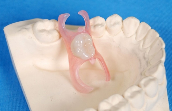 二、貴陽柏德口腔醫(yī)院鑲牙技術(shù)特色