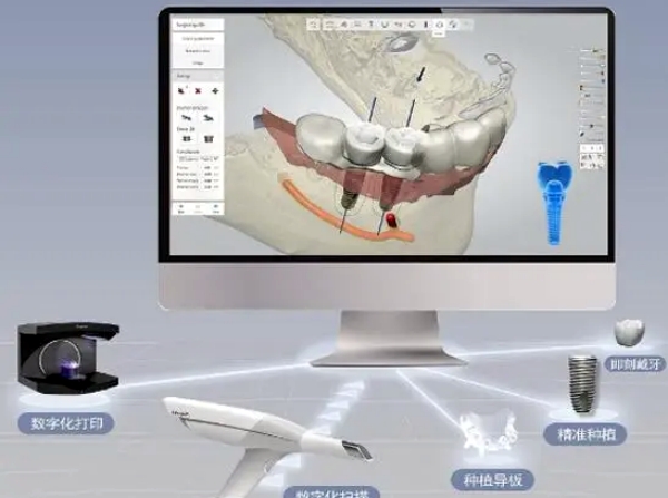 三、深圳華僑醫(yī)院口腔科服務(wù)項目與設(shè)備一覽：從基礎(chǔ)護理到復(fù)雜治療