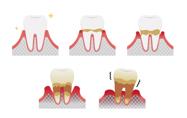 杭州看牙周炎好的十大牙科醫(yī)院