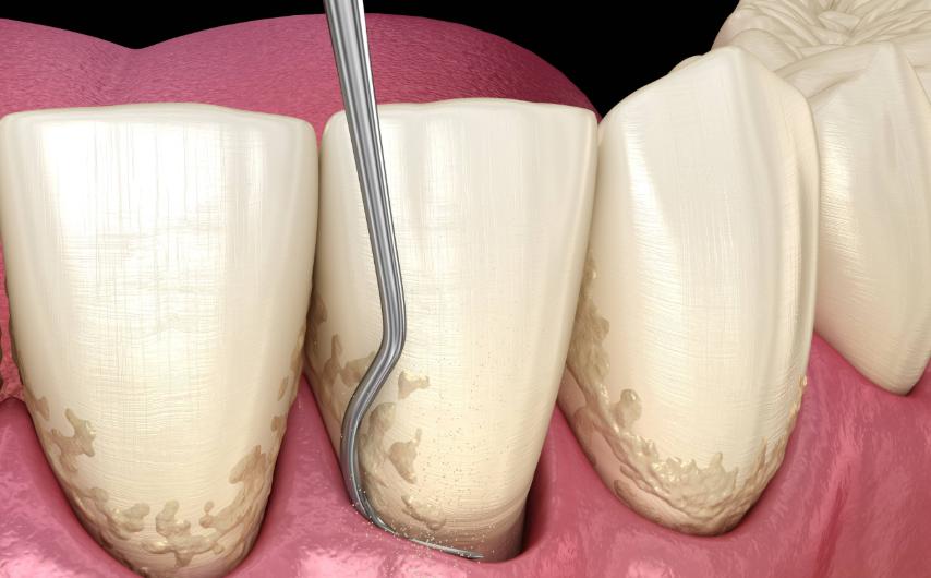 三、深圳友睦口腔牙周科主打項目（整容黨重點關(guān)注）