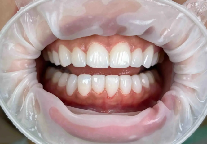 關于煙臺中幸口腔醫(yī)院用戶較常問的幾個問題（FAQ）