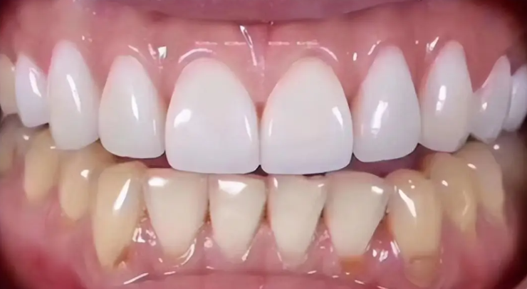 五、圍繞榆林德系口腔的常見問題解答