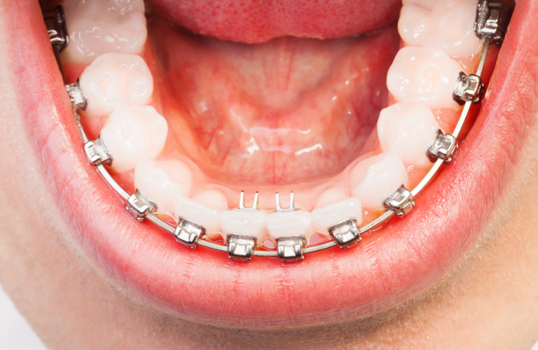 蘄春英博爾口腔