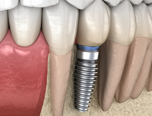 泗陽(yáng)優(yōu)諾口腔在技術(shù)與價(jià)格上的雙重確保