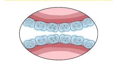 二、西安達芬琪口腔牙齒正畸價格詳情