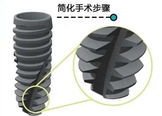 建湖牙科醫(yī)院哪家好？ 拒絕盲目跟風(fēng)！實(shí)測(cè)建湖 3 家擅長(zhǎng)“無(wú)痛種牙”的高人氣機(jī)構(gòu)