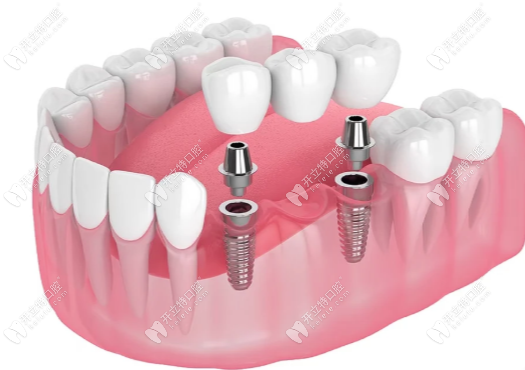 陳浩醫(yī)生背景：武大中南口腔進(jìn)修背景