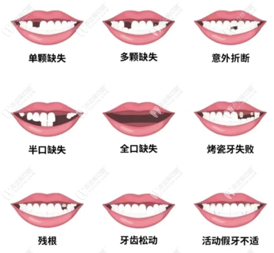  用戶關(guān)心的：在陳浩醫(yī)生這看牙是一種什么體驗(yàn)？