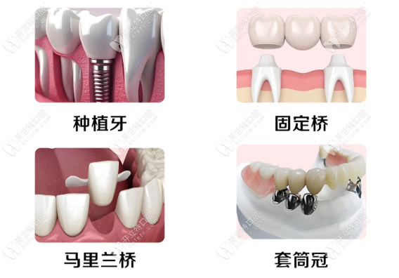 牙友關(guān)心的：丁潔醫(yī)生的面診細(xì)節(jié)與體驗(yàn)