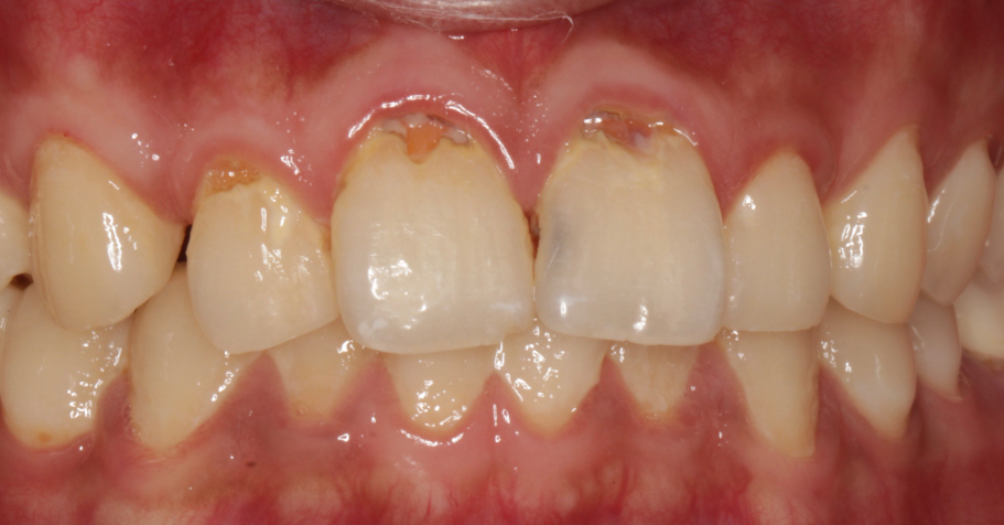 四、廣州致友醫(yī)院口腔科價格參考
