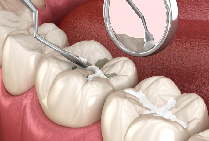 二、廣州致友醫(yī)院口腔科真實評價