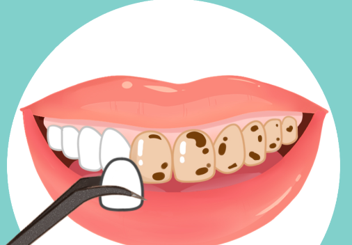 五、想去看牙，具體怎么預(yù)約和準(zhǔn)備？