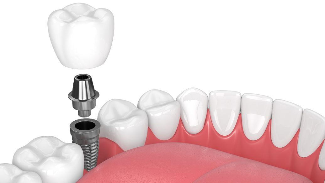 荊州澳爾口腔江漢門診部診療項目及價格體系詳解