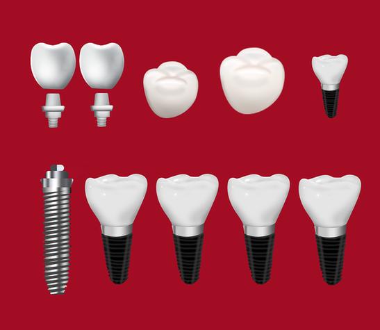 四、深圳格倫菲爾簡單選擇公式（不想看太多直接看這段）ardc-srvc.com