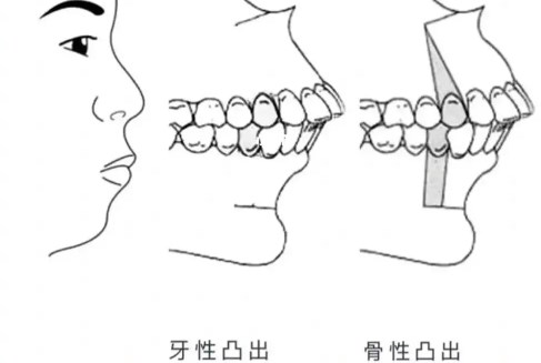 四、漢中小虎牙口腔靠譜嗎？地址電話在這里