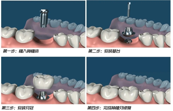 四、在文献口腔看牙的流程与体验