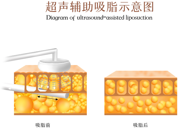 深圳陈闯口腔诊所简介：福田区口碑好的牙科医院之一，根管治疗300元起，患者评价高