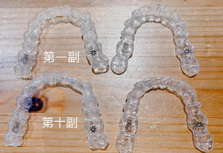 二、贵阳朗朗口腔矫正牙齿技术好吗？我面诊刘艳医生的真实体验