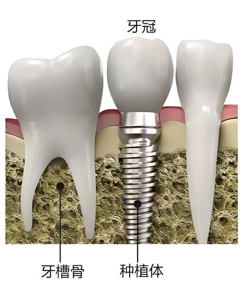 三、关于盐城雅洁口腔医院价目表的常见问题解答www.kelete.com