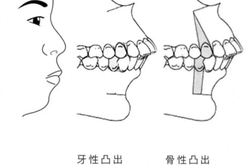 四、除了技术,潮州天伦口腔矫正牙齿的“软服务”怎么样?