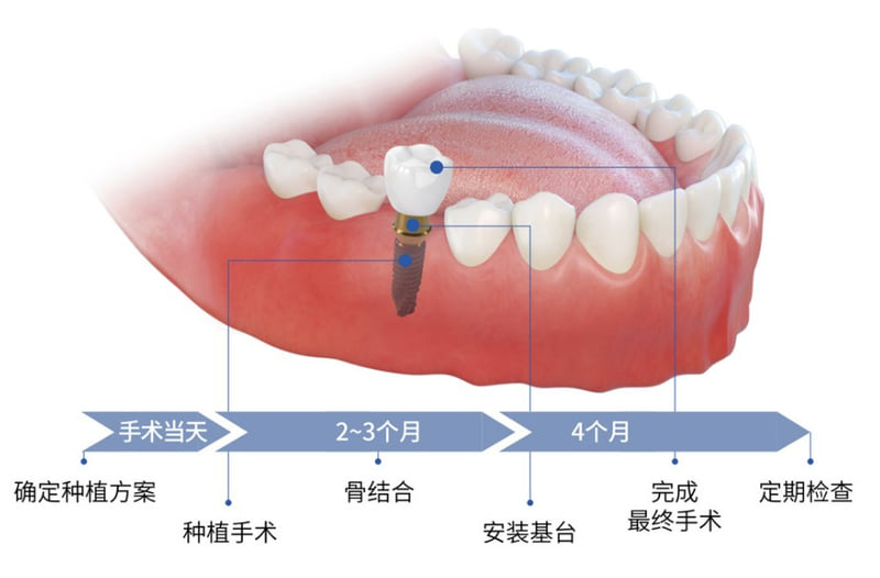三、关于新化健齿口腔看牙的常见疑问解答（Q&A）
