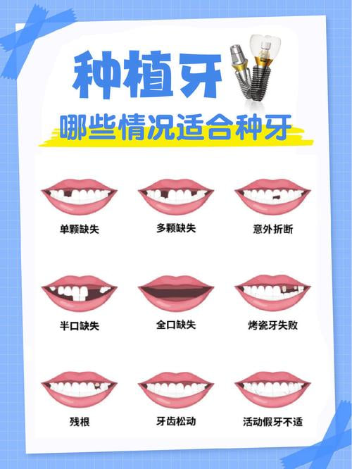 六、常见问题解答