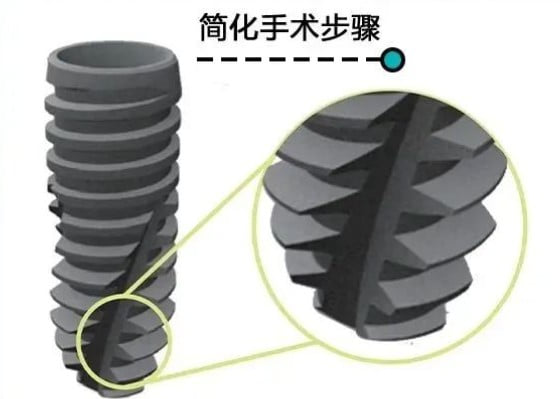 2. 半口与全口种植牙修复价格