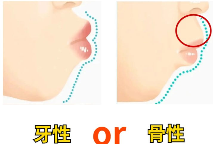 六、东莞口腔医院正畸到院流程与避坑指南