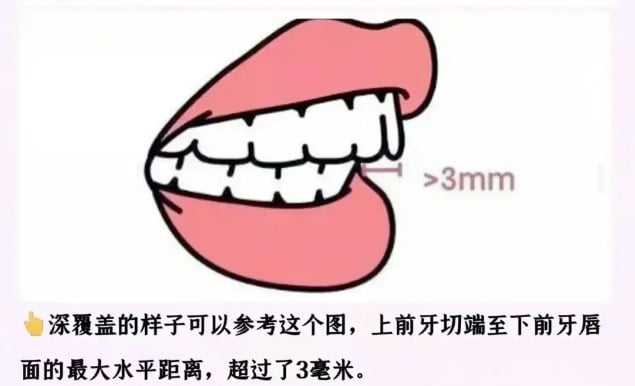 八、东莞暑期矫牙热门疑难问答（Q&A）www.kelete.com