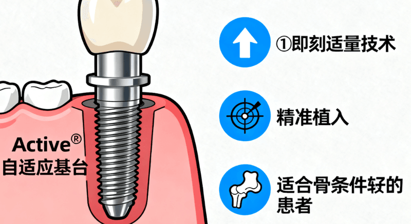 曲靖诺贝尔口腔种牙优缺点：技术稳收费透明，就是周末人多要早约