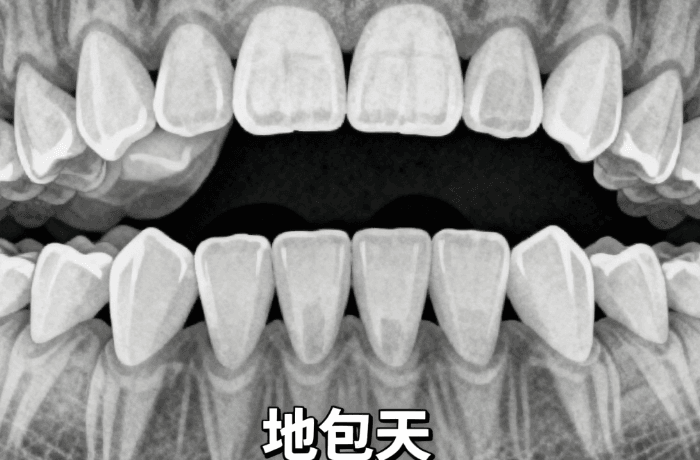 二、除了技术,南京爱齐博口腔刘阳医生看牙价格也是关键参考