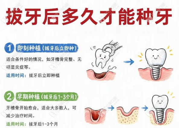 长春爱齿口腔种牙 长春爱齿口腔种牙