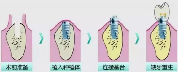 四、武汉贝客口腔价格表预约与价格确认渠道