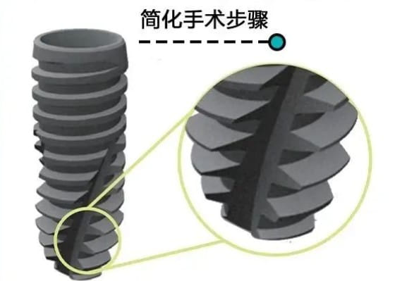 2026乌鲁木齐天牙口腔价格贵吗？种牙2980元起本地人直呼性价比爆表！
