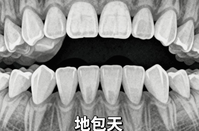五、深圳春分口腔预约时可以先了解的价格参考