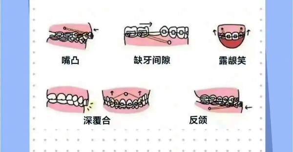 二、春分口腔预约为什么微信小程序算最快的通道
