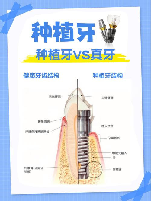 三、深圳爱康健口腔医院种植牙医生和技术怎么选