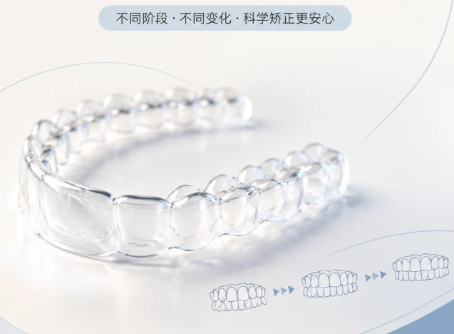 隐适美适合二次矫正吗?过来人真实经历告诉你答案,别再走弯路了!