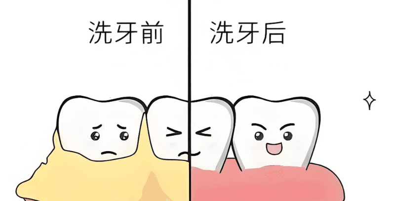 六、深圳爱康健口腔医院洗牙和收费的常见疑问