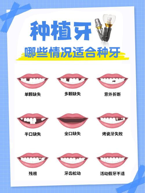 五、天津优齿泰华口腔价格在同城机构里算什么水平
