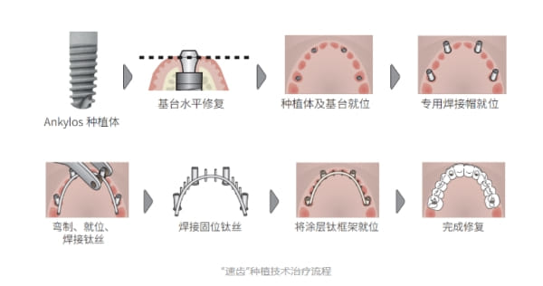 二、玉林牙精英口腔2026价目表里种牙2980起、矫正8888起是怎么算出来的