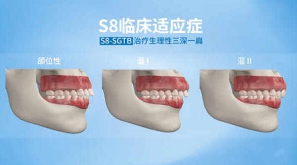 三、柳州蓝天口腔医院整牙方案怎么把关