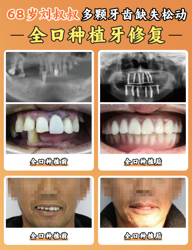 七、关于南昌博德口腔医院的常见疑问