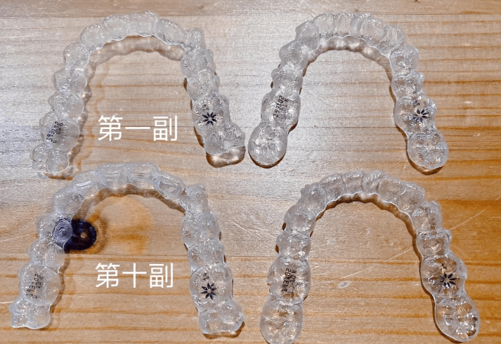 四、厦门思明牙天使口腔的隐形矫正18800元起值不值得做